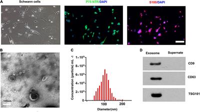 Schwann cells-derived exosomes promote functional recovery after spinal cord injury by promoting angiogenesis